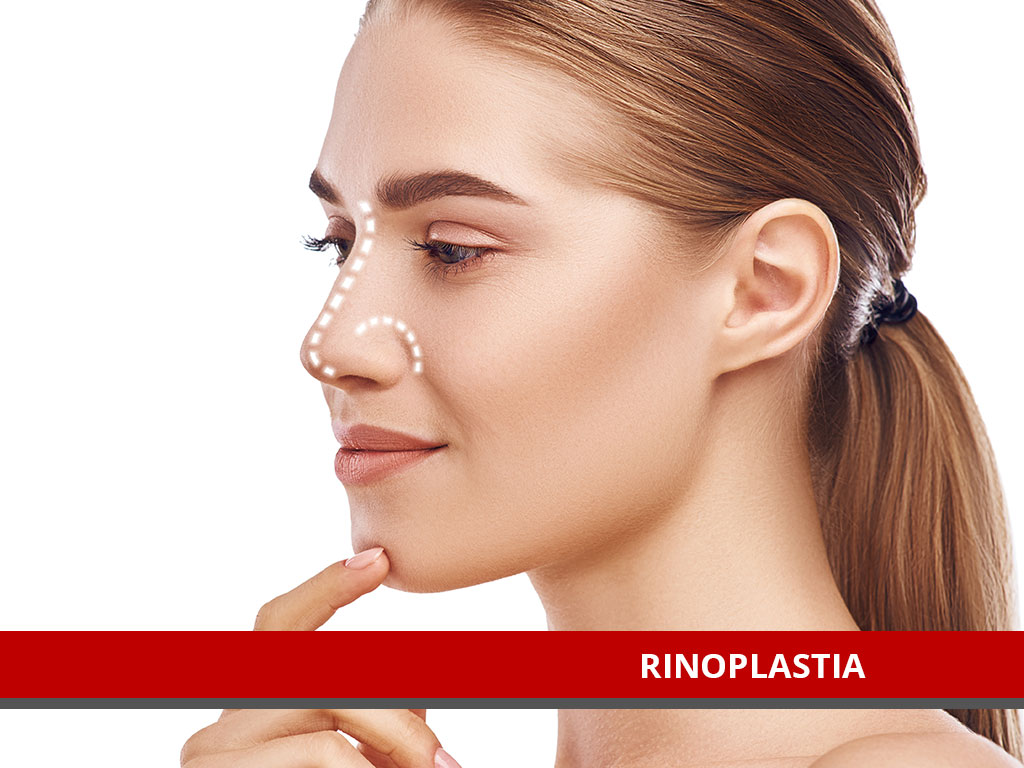 Cirugía de Rinoplastia en El Salvador