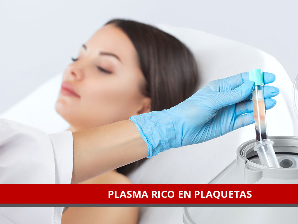 Tratamiento con Plasma Rico en Plaquetas en El Salvador